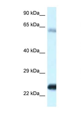 NDUFS8 Antibody (C-Terminus)