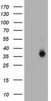 CD1C Antibody (clone OTI2F4)