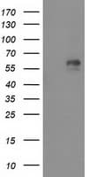 Monoclonal Mouse anti-Human AK5 / Adenylate Kinase 5 Antibody (clone OTI1G3, IHC, WB)