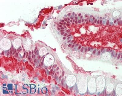 IHC-plus™ AKR1B10 Antibody (aa1-316)