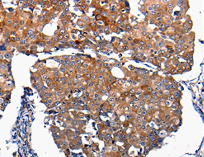 FGF2 / Basic FGF Antibody
