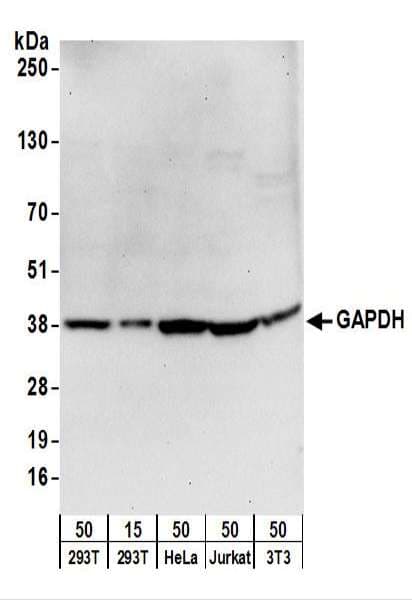 IHC-plus™ Polyclonal Goat anti-Human GAPDH Antibody (aa175-225, IHC, WB)
