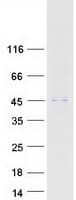 Human ABHD12 Protein (Recombinant Myc-DDK (Flag))