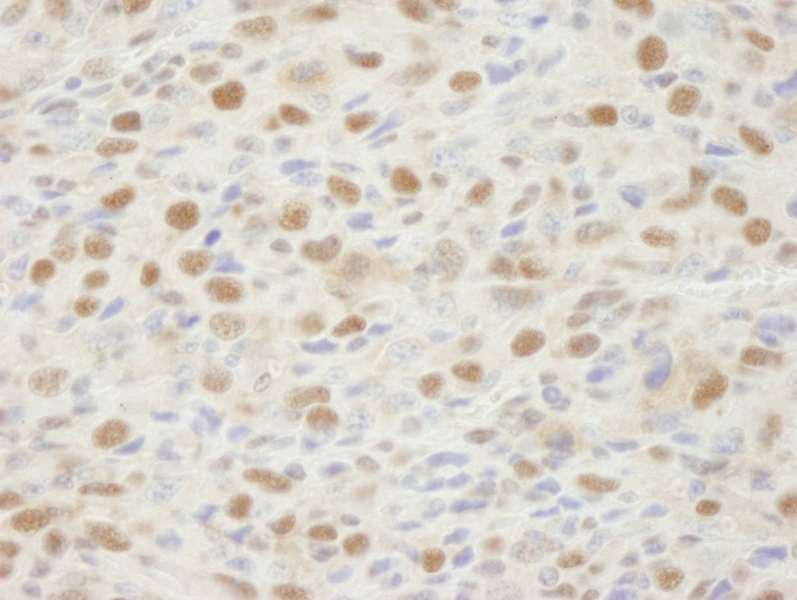 MSH2 Antibody (aa875-C-term)