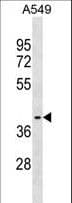 ZNF514 Antibody (aa49-76)