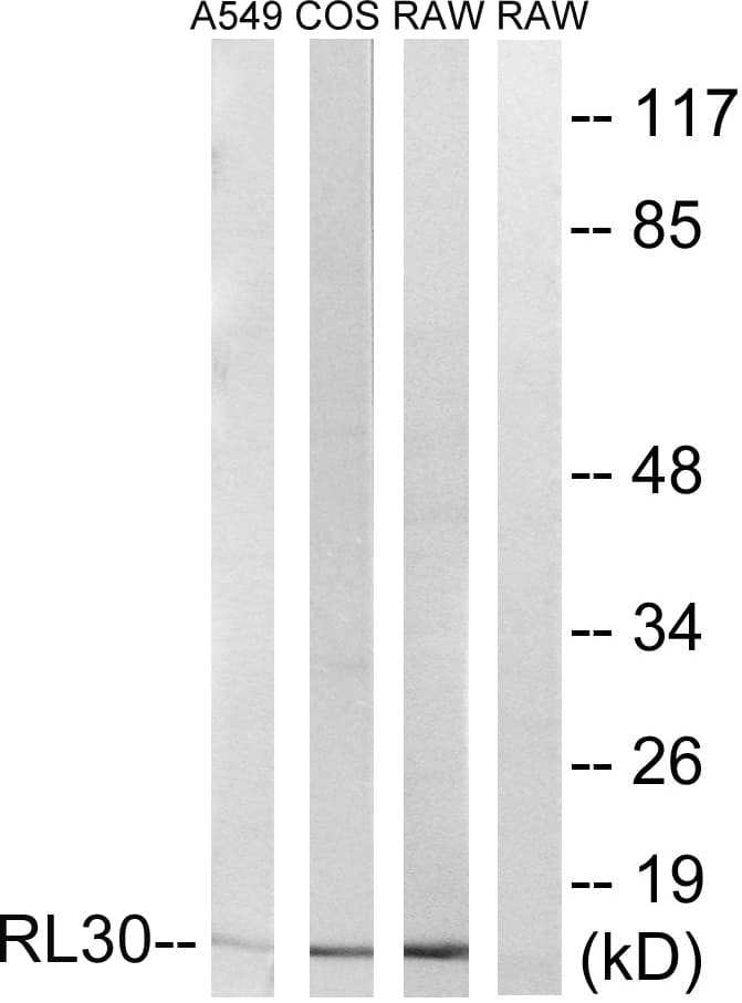 RPL30 / Ribosomal Protein L30 Antibody (aa66-115)