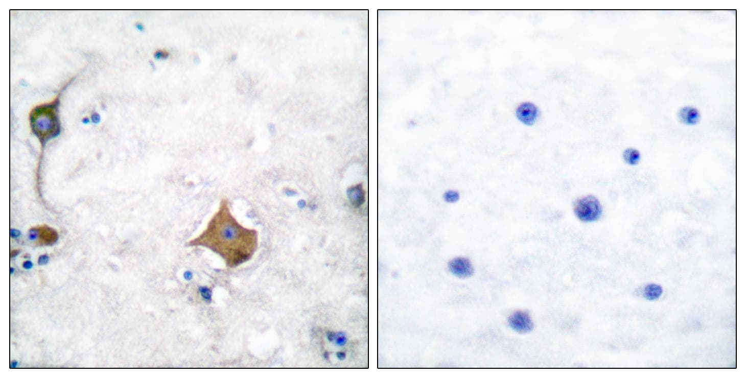 SYP / Synaptophysin Antibody