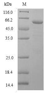 Human LSD / DNASE1L3 Protein (Recombinant GST, N-terminus)