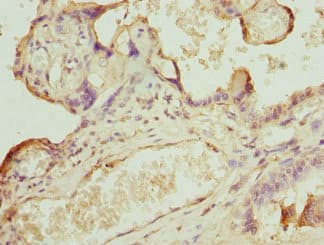 CAMK1D Antibody