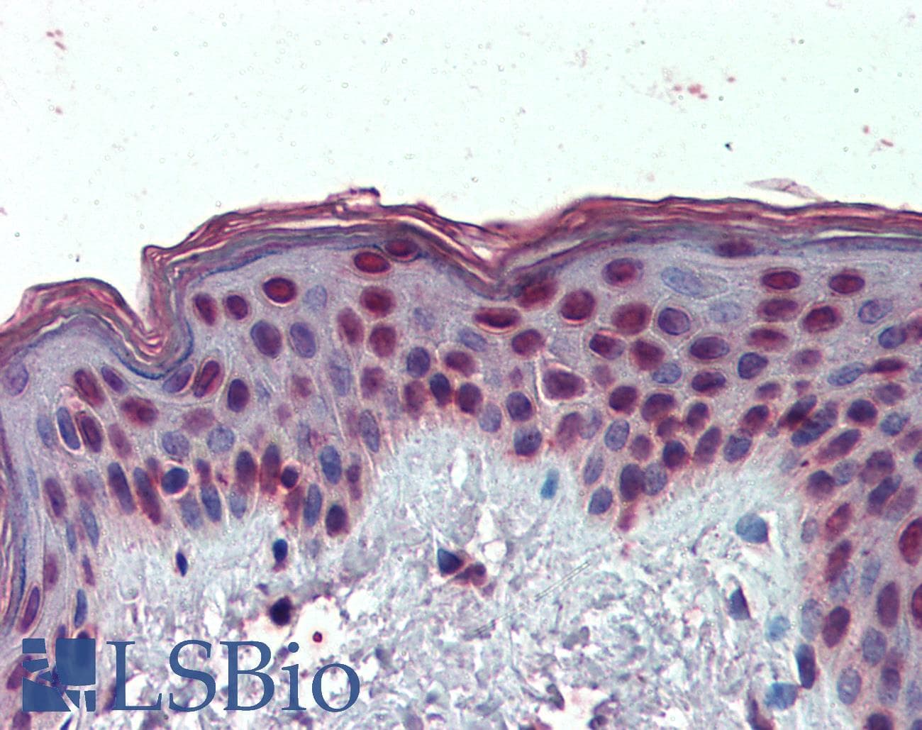 IHC-plus™ HMGIY / HMGA1 Antibody (aa9-21)