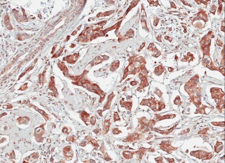 Polyclonal Rabbit anti-Human TULP1 Antibody (aa281-542, IHC, WB)