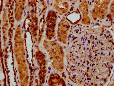 Polyclonal Rabbit anti-Human RYK Antibody (IHC, WB)