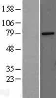 MED17 / TRAP80 Protein (Over-Expression Lysate Myc-DDK (Flag))