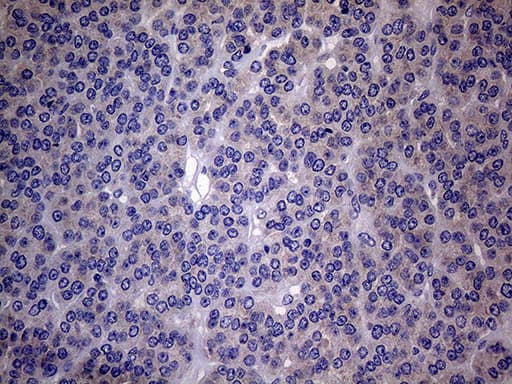 SCFD1 / SLY1 Antibody (aa66-190, clone OTI10D10)