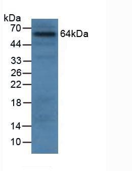 GRN / Granulin Antibody (aa21-120)