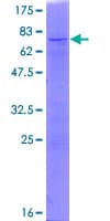 Human CTB / PCYT1B Protein (Recombinant GST)