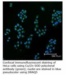 IHC-plus™ SOD1 / Cu-Zn SOD Antibody