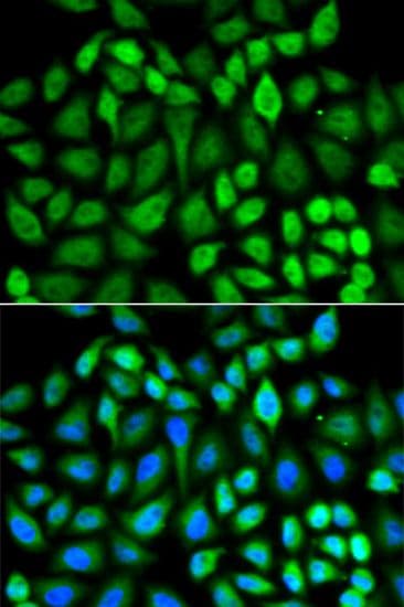 MAPK3 / ERK1 Antibody