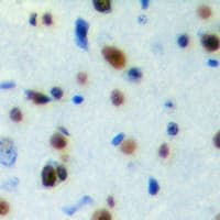 Polyclonal Rabbit anti-Human PA26 / SESN1 Antibody (Internal, IHC, WB)