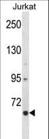 CRTC2 / TORC2 Antibody (aa94-123)