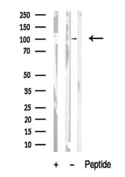 RBBP8 / CTIP Antibody