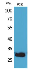 CD200 Antibody