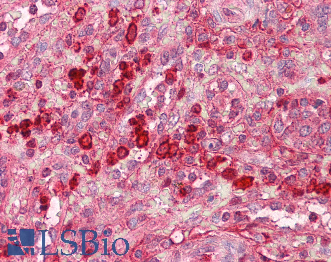 IHC-plus™ GZMB / Granzyme B Antibody (aa10-59)