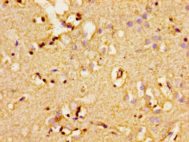 ADCY8 / Adenylate Cyclase 8 Antibody
