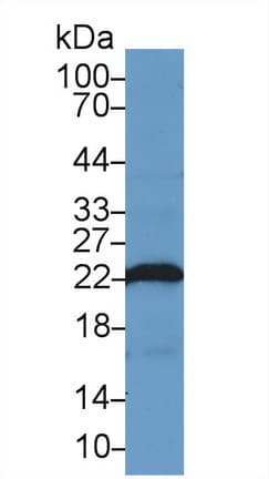PARK7 / DJ-1 Antibody (aa1-189, PE)