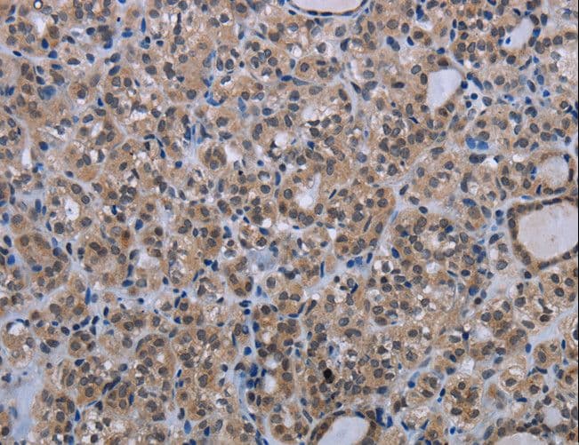 MAGEC1 Antibody