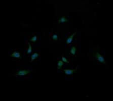 Monoclonal Mouse anti-Human MAP2K3 / MEK3 / MKK3 Antibody (clone OTI5B2, IHC, IF, WB)