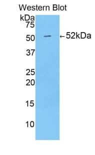 PRDX6 / Peroxiredoxin 6 Antibody (aa1-224)