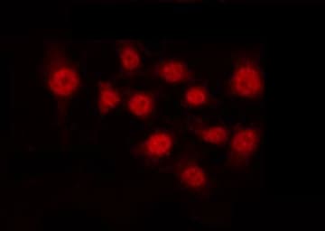 Polyclonal Rabbit anti-Human C/EBP Beta / CEBPB Antibody (phospho-Thr235,phospho-Thr188, IHC, IF, WB)