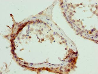 TRIM55 / MURF2 Antibody