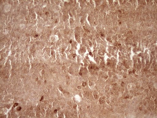 MMP3 Antibody (aa246-477, clone OTI2D9)