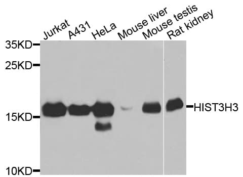Polyclonal Rabbit anti-Human Histone H3 Antibody (IHC, IF, WB)