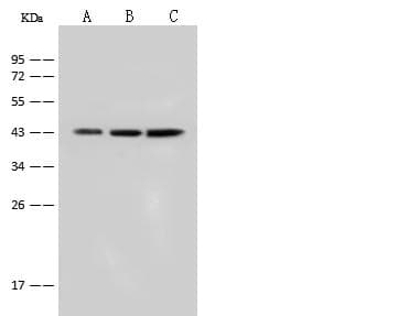 KRT18 / CK18 / Cytokeratin 18 Antibody (Preservative Free)