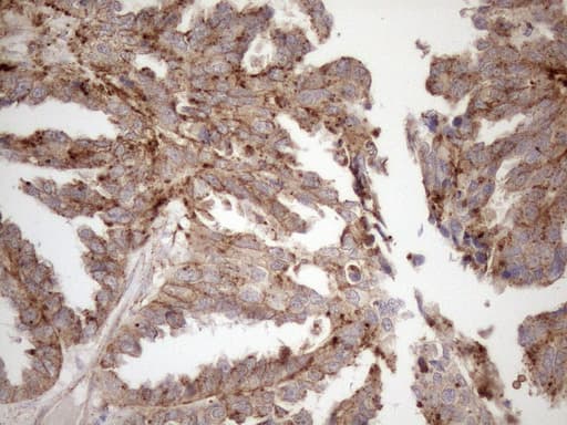 Monoclonal Mouse anti-Human KCTD9 Antibody (clone OTI2G8, aa1-223, IHC, WB)