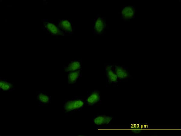 IHC-plus™ Monoclonal Mouse anti-Human CSE1L Antibody (clone 3F8, IHC, IF, WB)