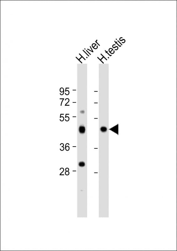 CHTF8 / C10orf18 Antibody (aa2-33)