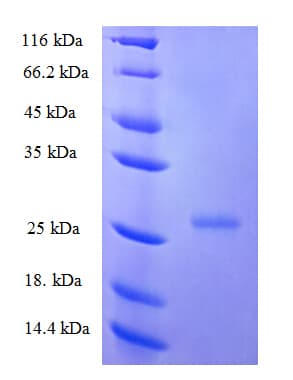 Human IFNE / Interferon Epsilon Protein (Recombinant His)