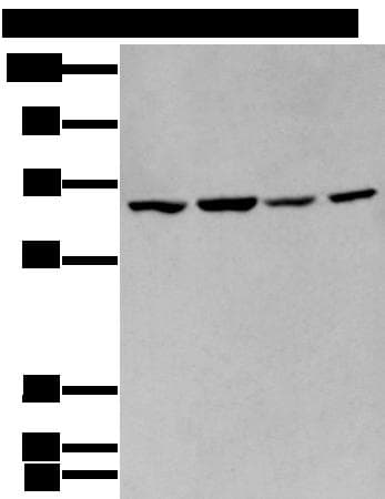 Polyclonal Rabbit anti-Human IMP-3 / IGF2BP3 Antibody (IHC, WB)