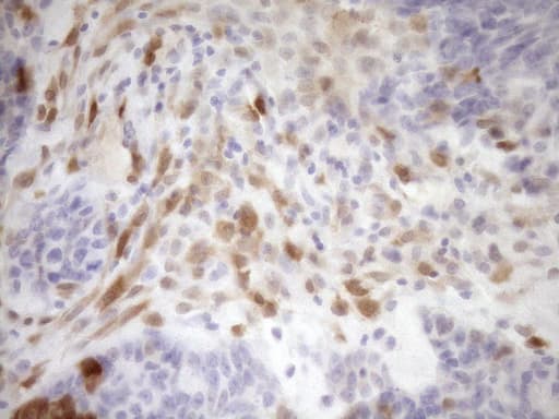 p16INK4a / CDKN2A Antibody (clone OTI1H3)