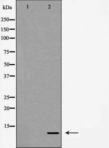 IL8 / Interleukin 8 Antibody
