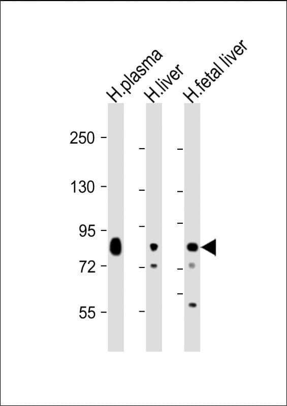 TF / Transferrin Antibody