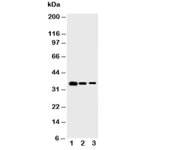 BIRC5 / Survivin Antibody