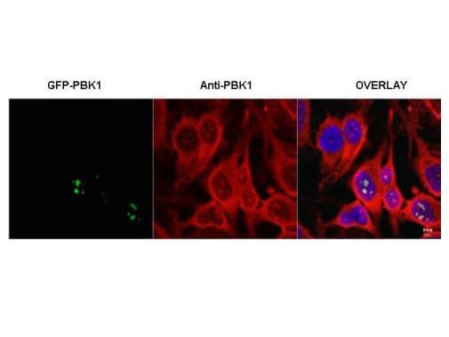 RSL1D1 Antibody