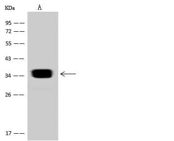 SULT2A1 / Sulfotransferase 2A1 Antibody