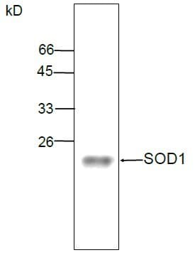 SOD1 / Cu-Zn SOD Antibody