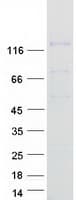 Human CD135 / FLT3 Protein (Recombinant Myc-DDK (Flag))